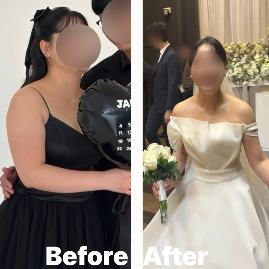 여수 동안관리잘하는곳 비포애프터 5