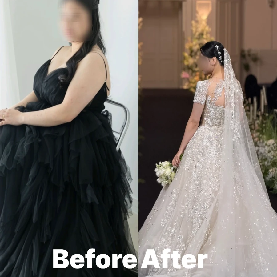 여수 동안관리잘하는곳 비포애프터 6
