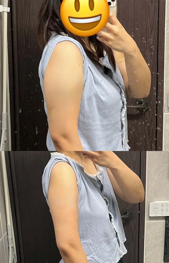 여수 동안관리잘하는곳 비포애프터 4